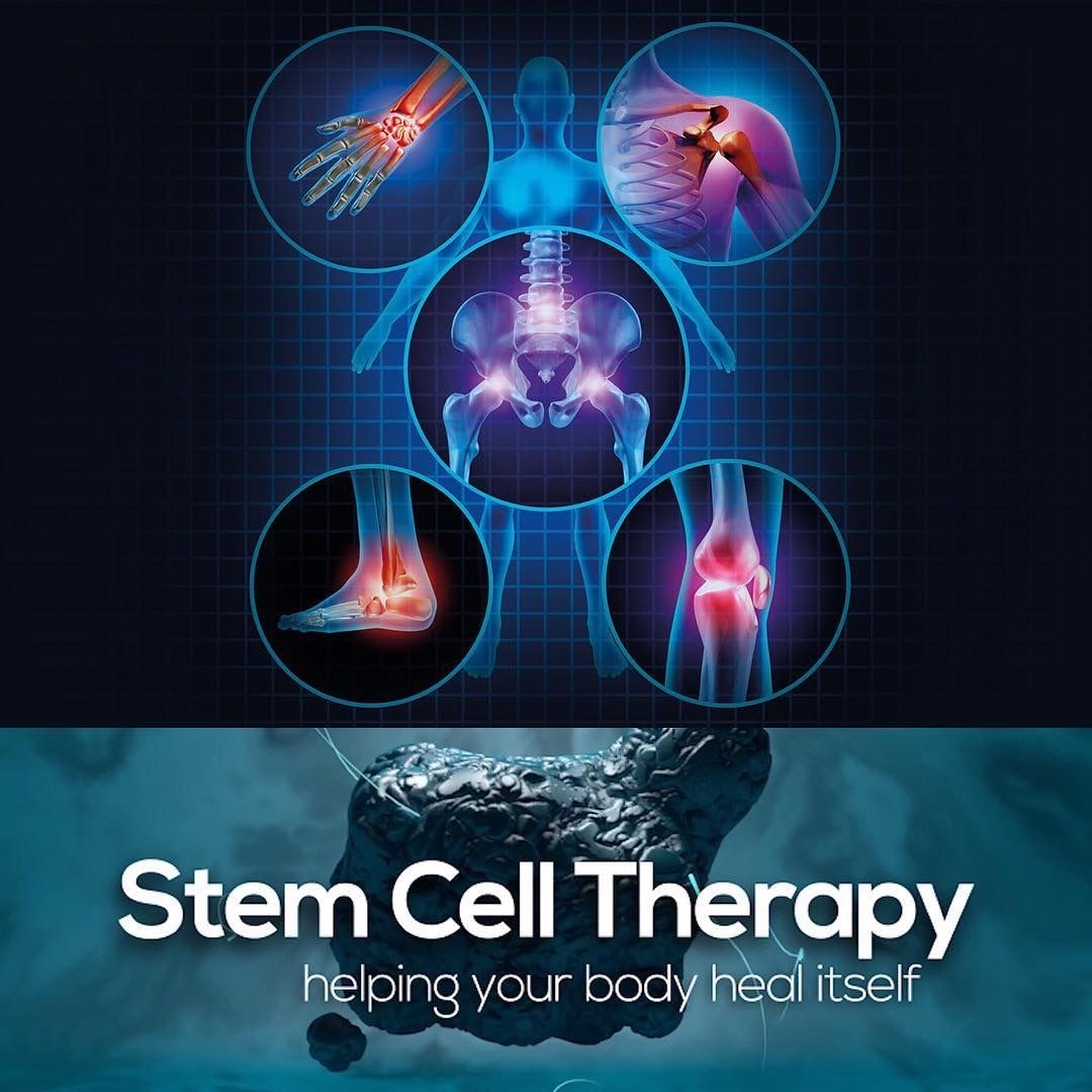 Stem Cell Therapy - Helping Your Body Heal Itself